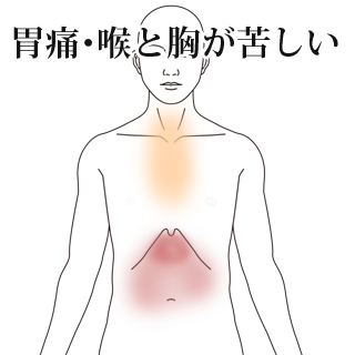 鍼による逆流性食道炎の症例