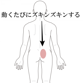 腰が動くたびにズキンズキンする