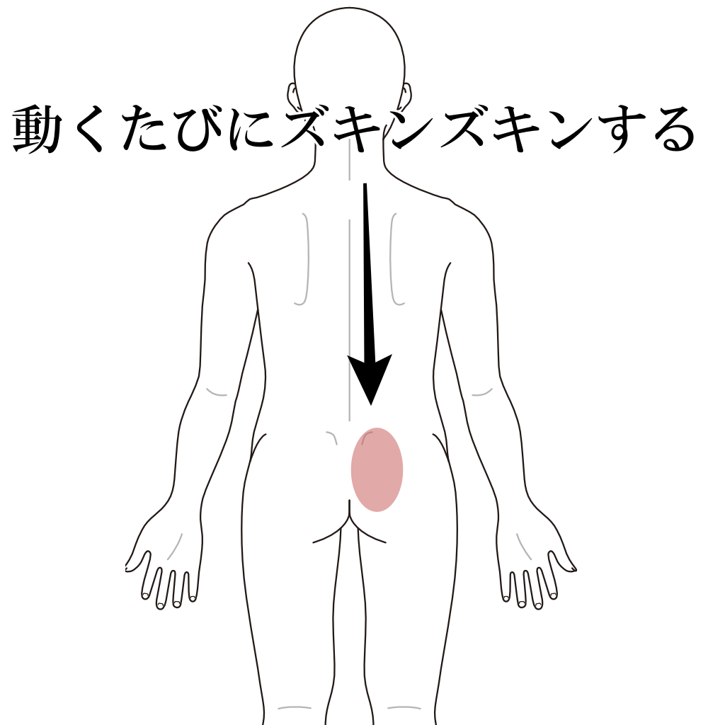 腰が動くたびにズキンズキンする