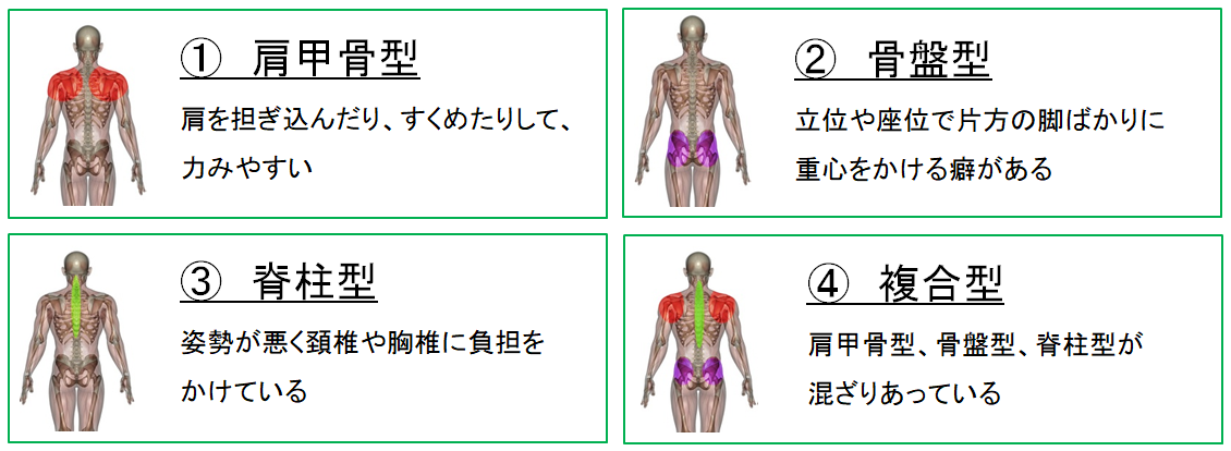 腱鞘炎　4つの特徴