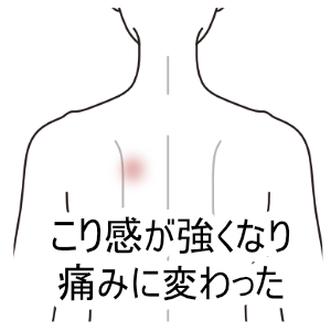 コリ感が痛みに変わる