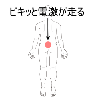 ビキッと電撃走るぎっくり腰