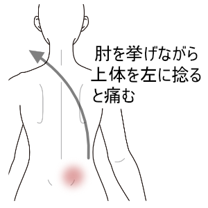 上体を左に捻ると痛む