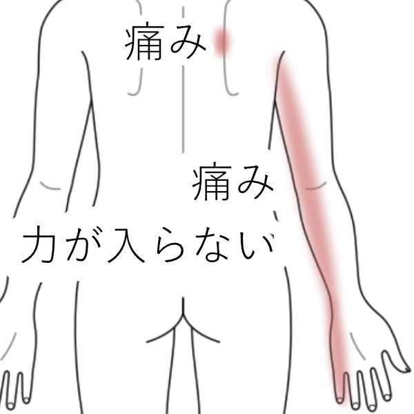 症例_KY_腕の小指側のラインが痛み力が入らない