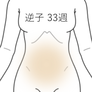 逆子33週