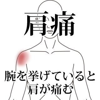 鍼治療による肩痛の改善例