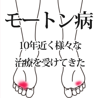 鍼で改善したモートン病の症例ー埼玉県志木市のいろは治療院ー