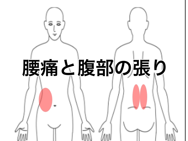 腰痛と腹部の張り