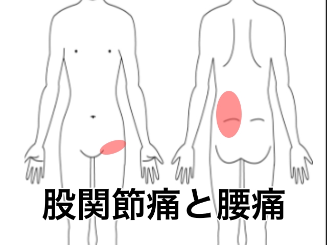 股関節痛四つうう